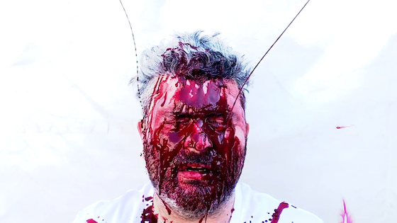 Antikörper1 560 Screenshot u